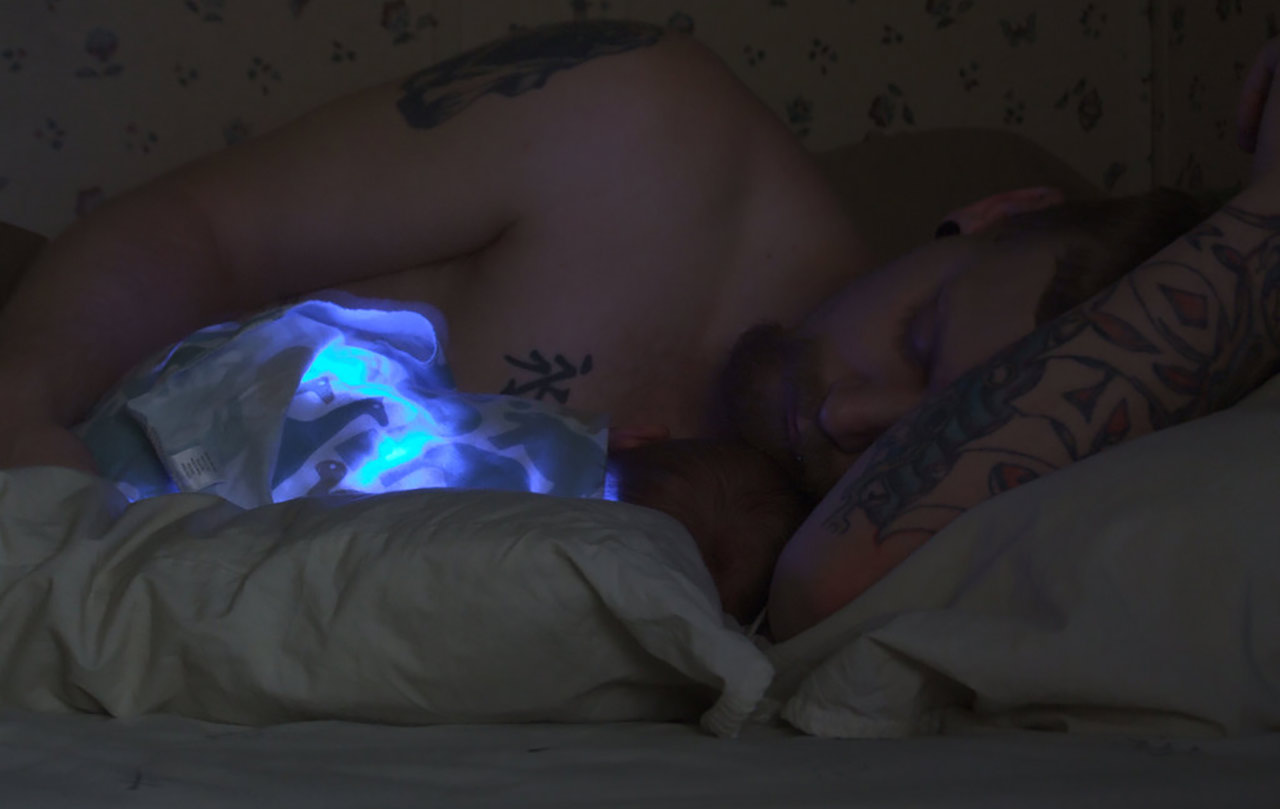 light-therapy